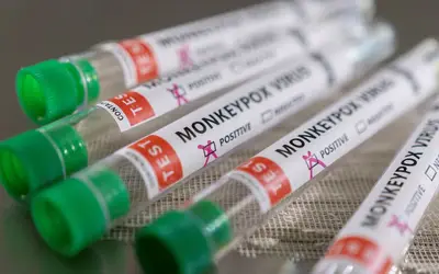 Ministério da Saúde confirma nono caso de varíola dos macacos no país