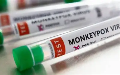 Quatro casos suspeitos da varíola dos macacos (Monkeypox) são descartados pela Sesau