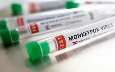 Sobe para 24 o número de notificações de casos suspeitos de Monkeypox em AL