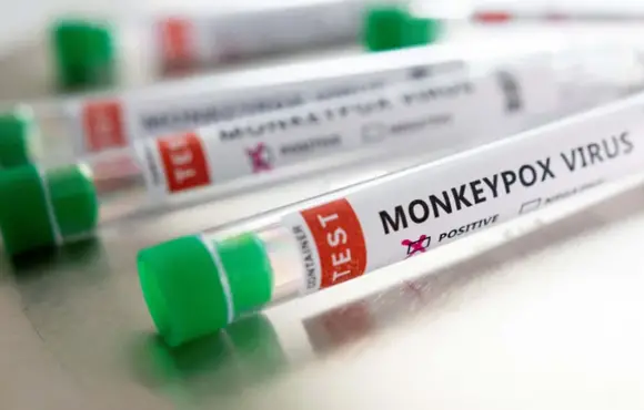 Sobe para 24 o número de notificações de casos suspeitos de Monkeypox em AL